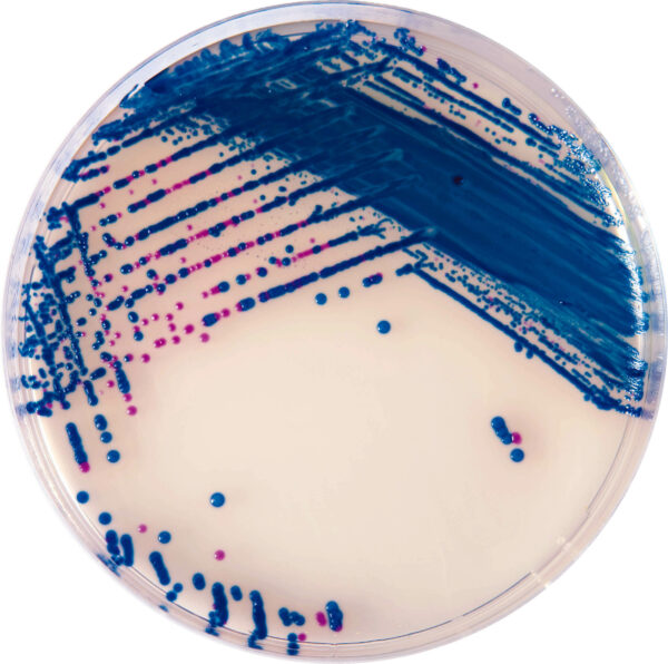 [201007] CHROMagar™ StrepB, 20 kasutusvalmis tassi