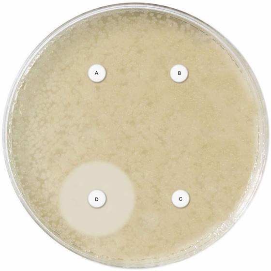 AmpC + ESßL Detection discs Set D68C, 4 kasetės po 50 ID diskelių
