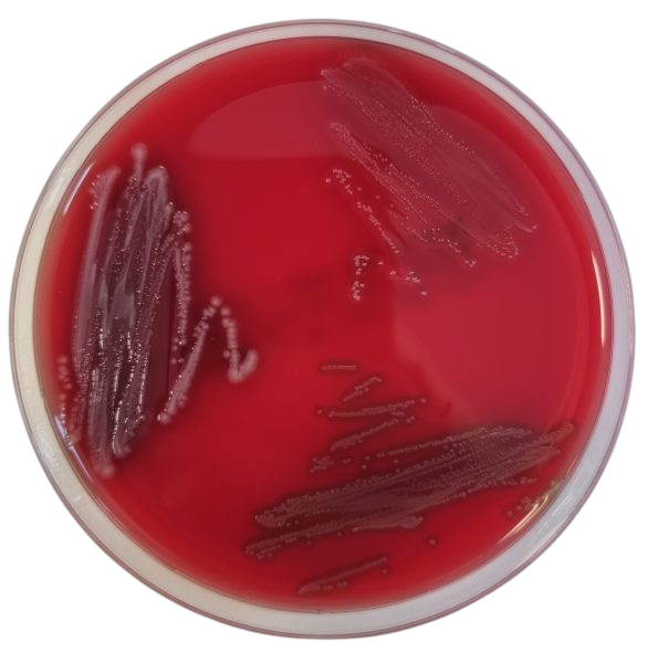 [201190] Columbia-Agar su 5 % avies krauju, 20 paruoštų naudoti lėkštelių