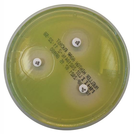 [201051] Mueller Hinton II Agar (EUCAST), 20 lietošanai gatavas platītes