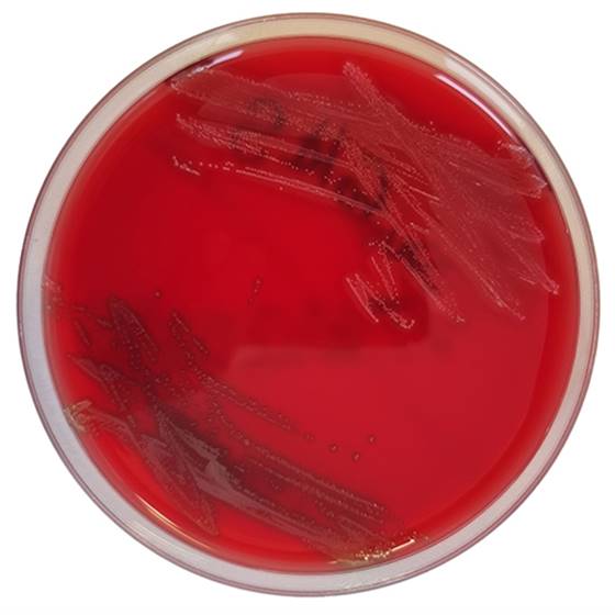 [201370] Mueller Hinton II Agar w. 5 % horse blood + 20 mg/l NAD EUCAST, 20 lietošanai gatavas platītes