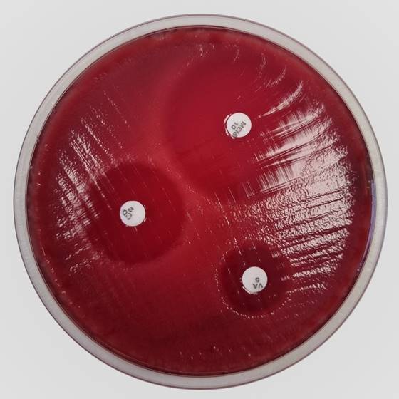 [201371] Fastidious Anaerobe Agar (FAA) ar 5 % zirgu asinīm, 20 lietošanai gatavas platītes