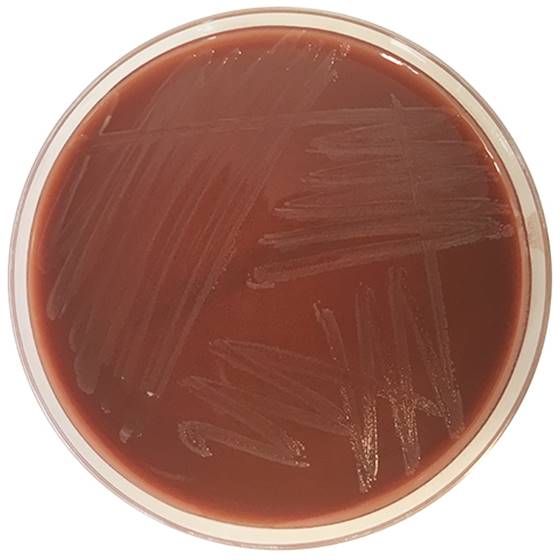 [201261] Haemophilus Chocolate Agar su bacitracinu, 20 paruoštų naudoti lėkštelių