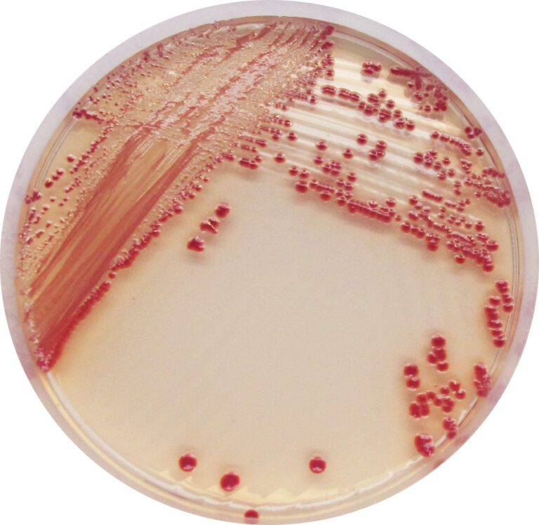 CHROMagar™ Acinetobacter